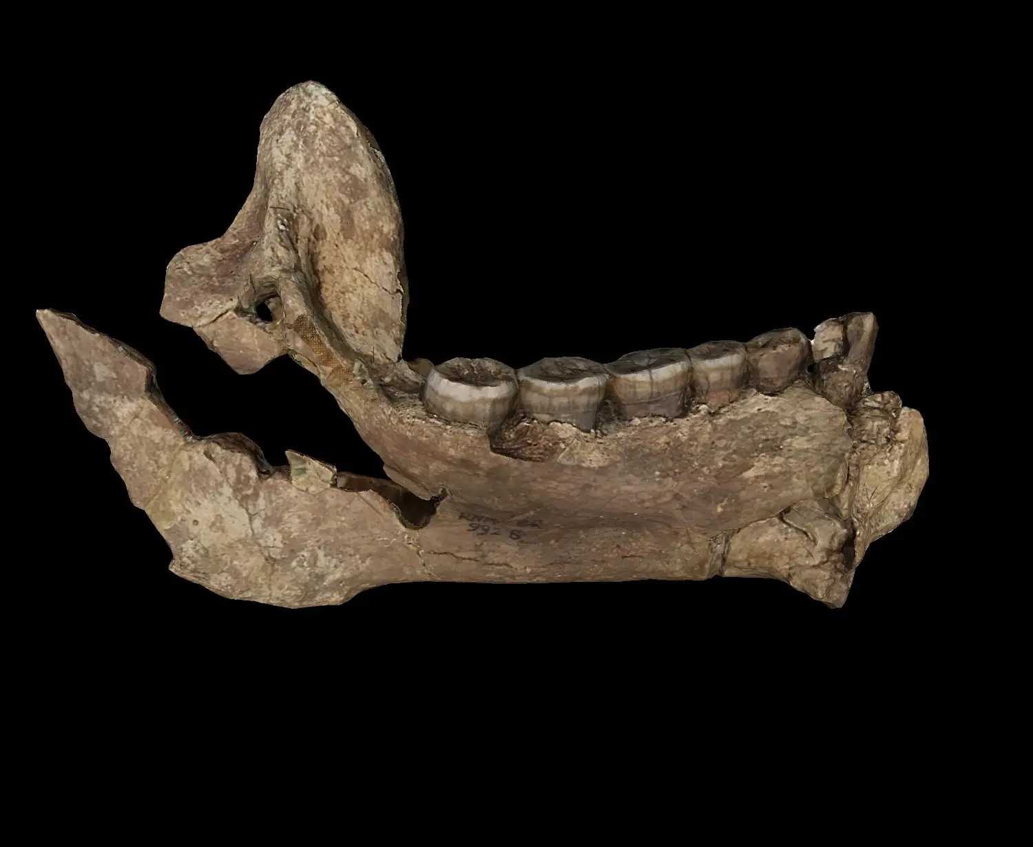 KNM-ER 992 (Homo ergaster)